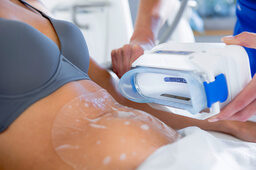 Eine Frau wird mit Coolsculpting in Bad Griesbach im St. Wolfgang behandelt